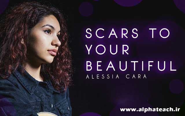 دانلود آهنگ Alessia Cara - Scars To Your Beautiful